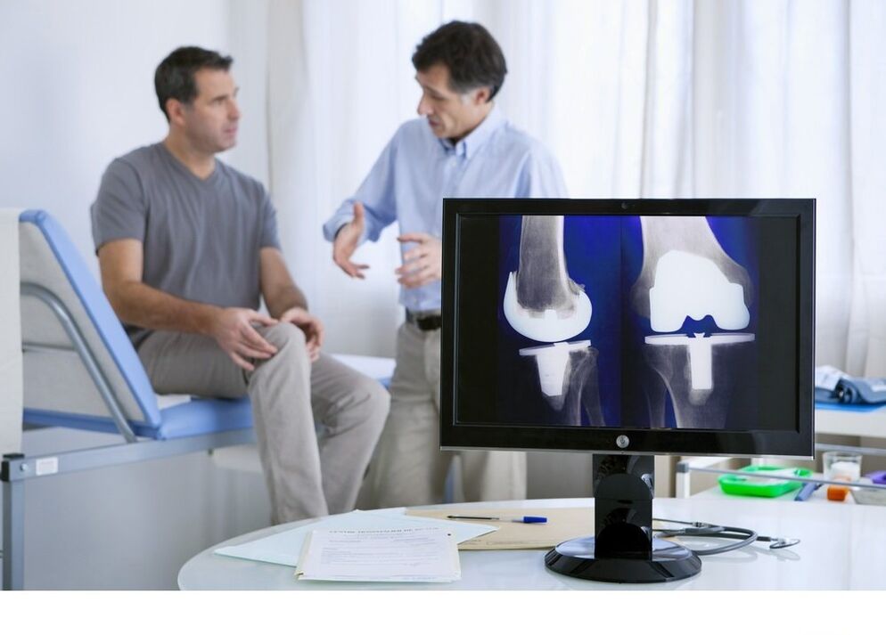 Osteoarthritis of the knee joint in the x-rash image